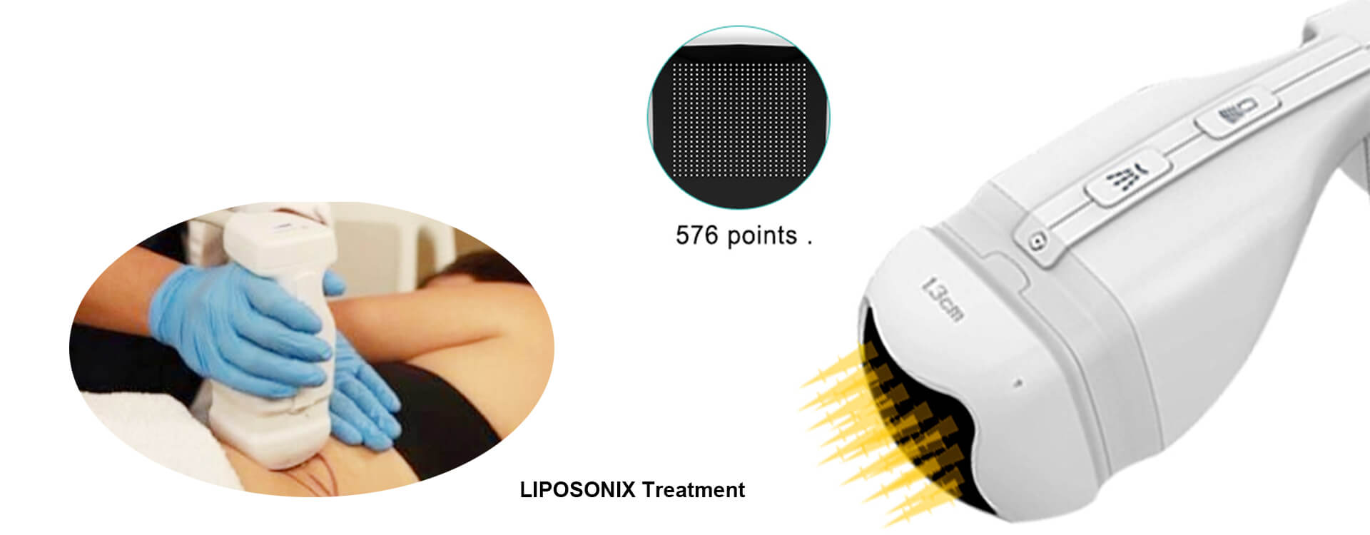 What Is The Operation Guides Of Liposonix? - Q & A | PrettyLasers