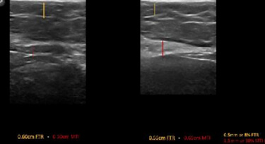 Muscle mass increased by 30% and fat thickness decreased by 8%