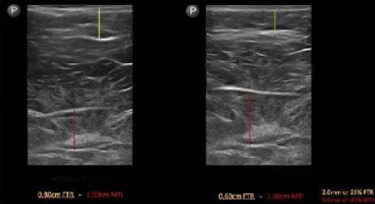 Red line shows 30% increase in muscle mass. Yellow line shows 25% decrease in fat thickness.