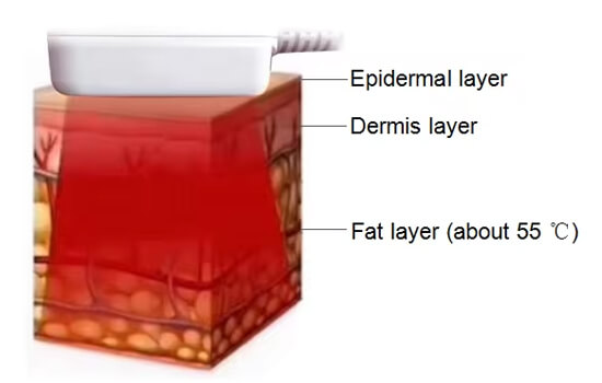 subcutaneous-fat-temperature