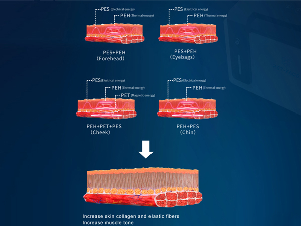 How does prenasFace® work?