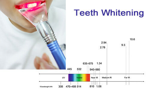 Teeth whitening